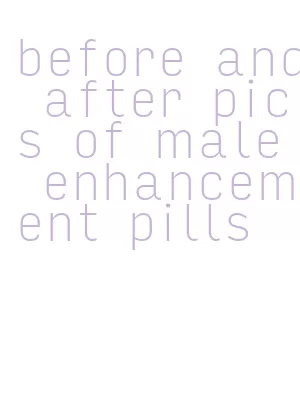 before and after pics of male enhancement pills